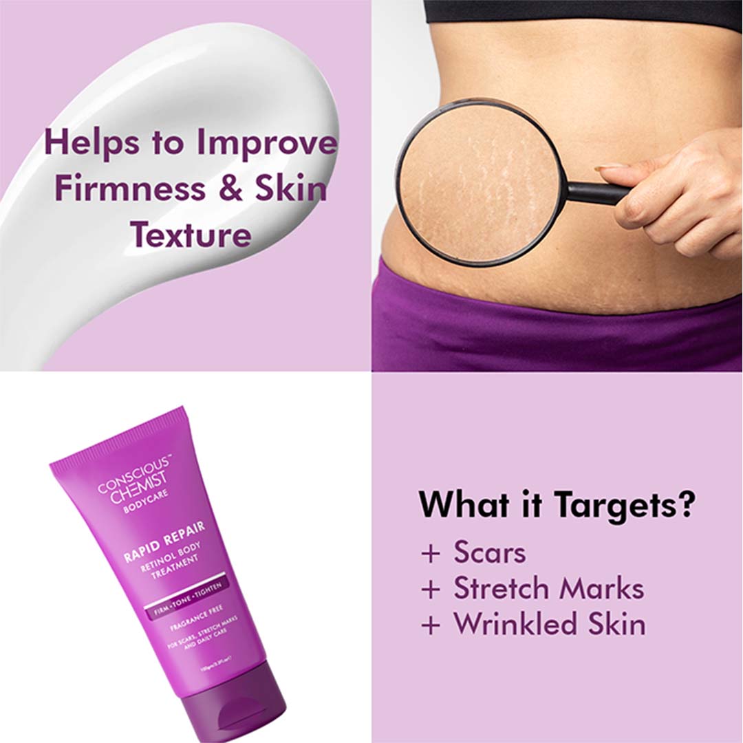 Conscious Chemist® Retinol Body Cream For Stretch marks, Uneven Skin Tone & Scars - Super Saver Pack