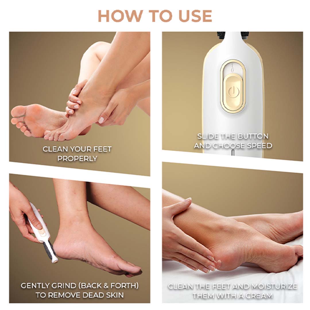 Winston Callus Remover for Healing Cracked Feet & Dead Skin Removal