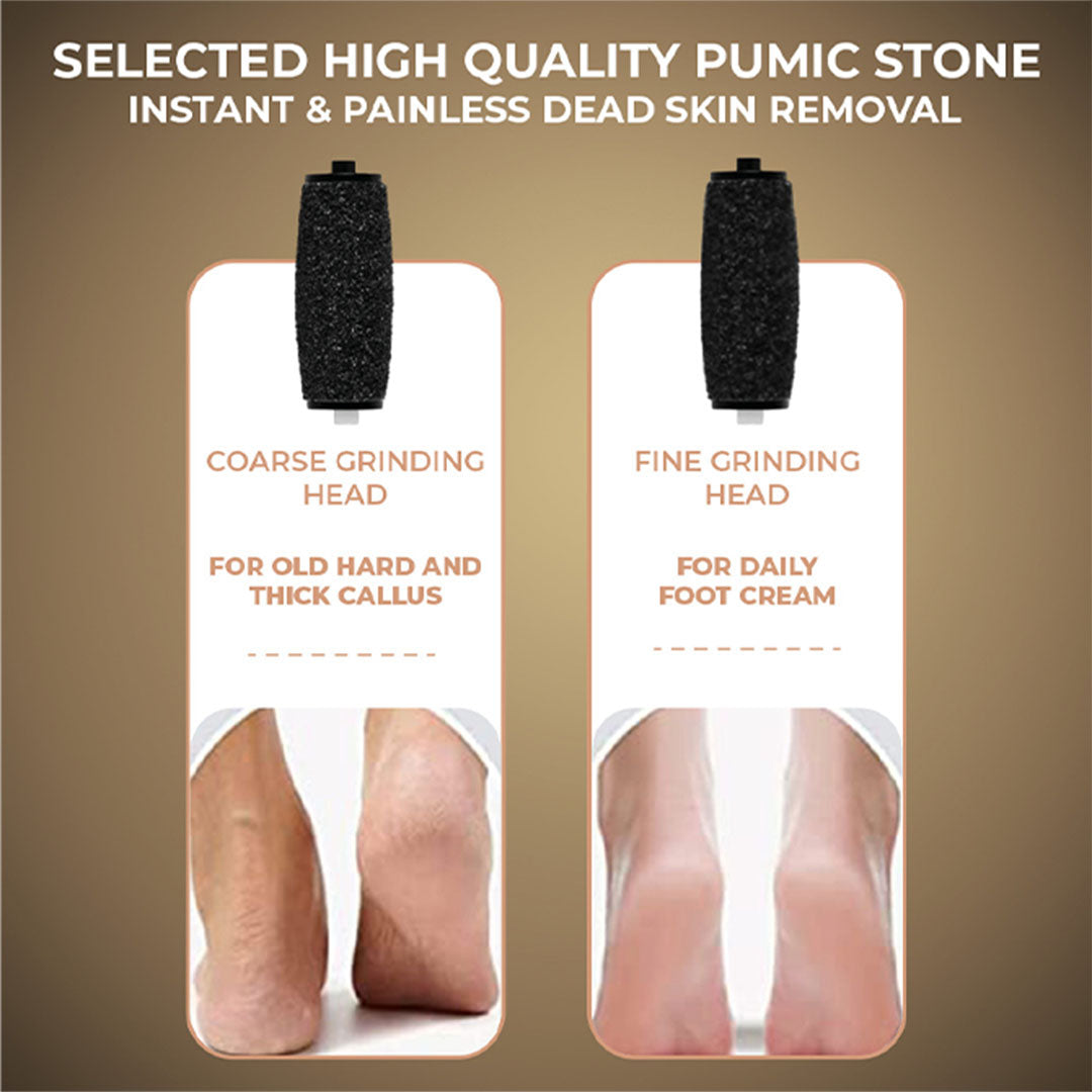 Winston Callus Remover for Healing Cracked Feet & Dead Skin Removal