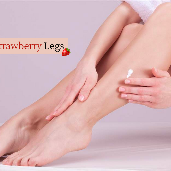 How to Treat Strawberry Legs | Vanity Wagon