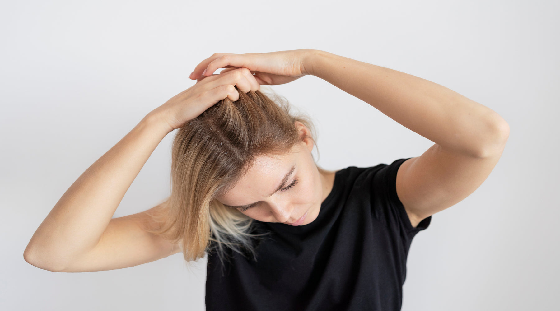 The Ultimate Guide to Relieving your Itchy Scalp
