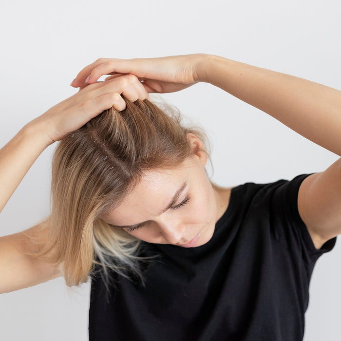 The Ultimate Guide to Relieving your Itchy Scalp