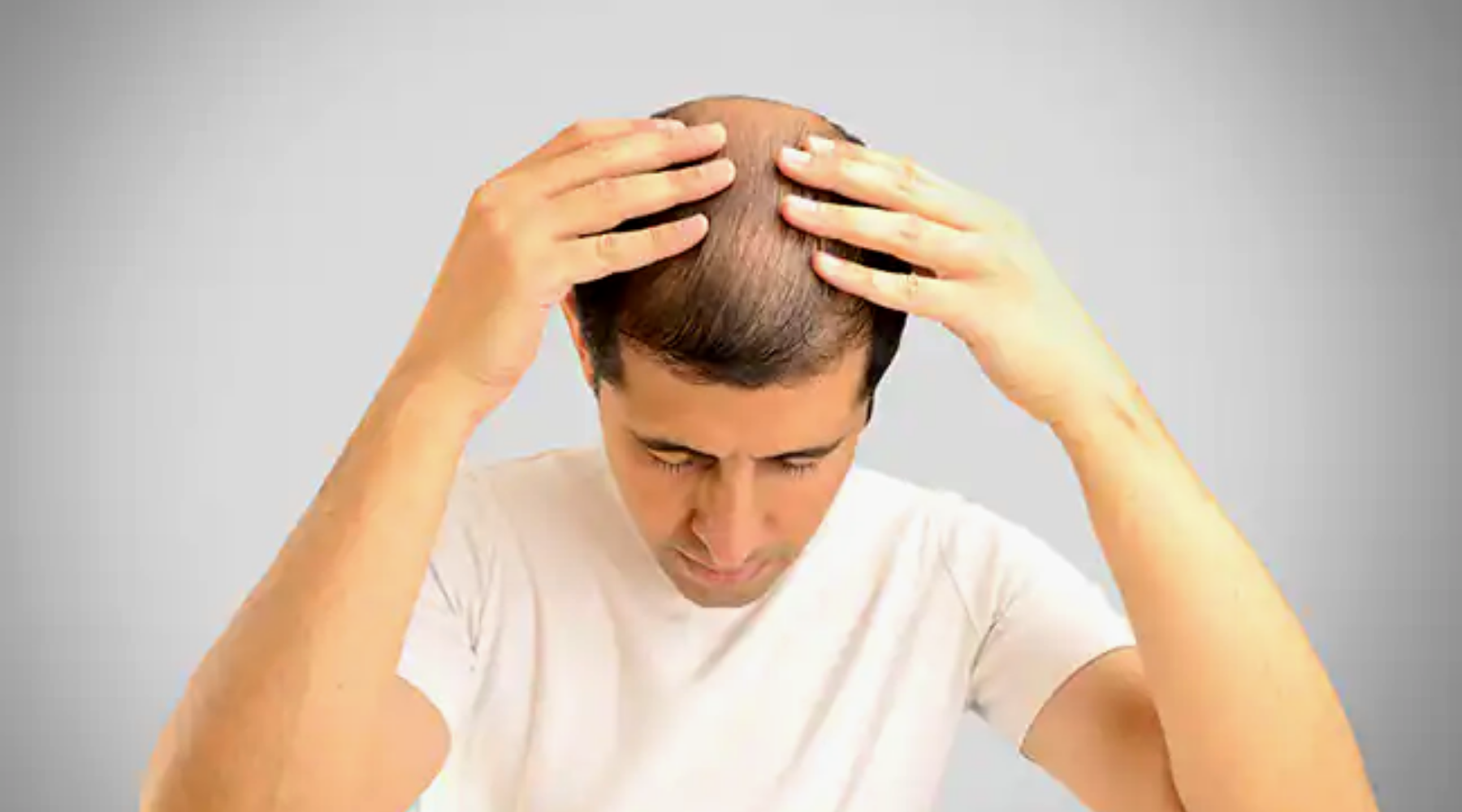 Natural Tips to Prevent Hair Loss in Men & Women