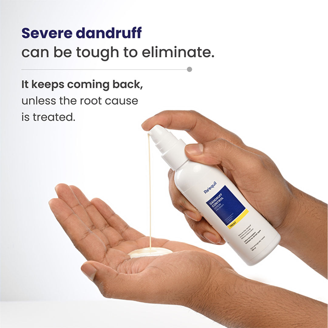 Re'equil Pre Wash Anti-Recurrence Dandruff Lotion