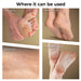 Vanity Wagon | Buy Winston Callus Remover for Healing Cracked Feet & Dead Skin Removal