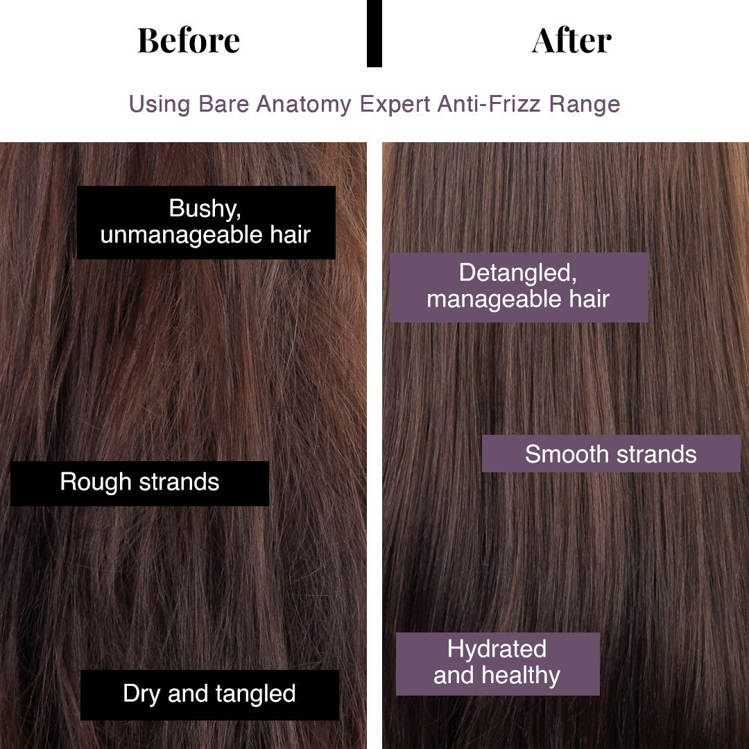 Vanity Wagon | Buy Bare Anatomy Expert Anti-Frizz Shampoo for Frizzy & Unruly Hair