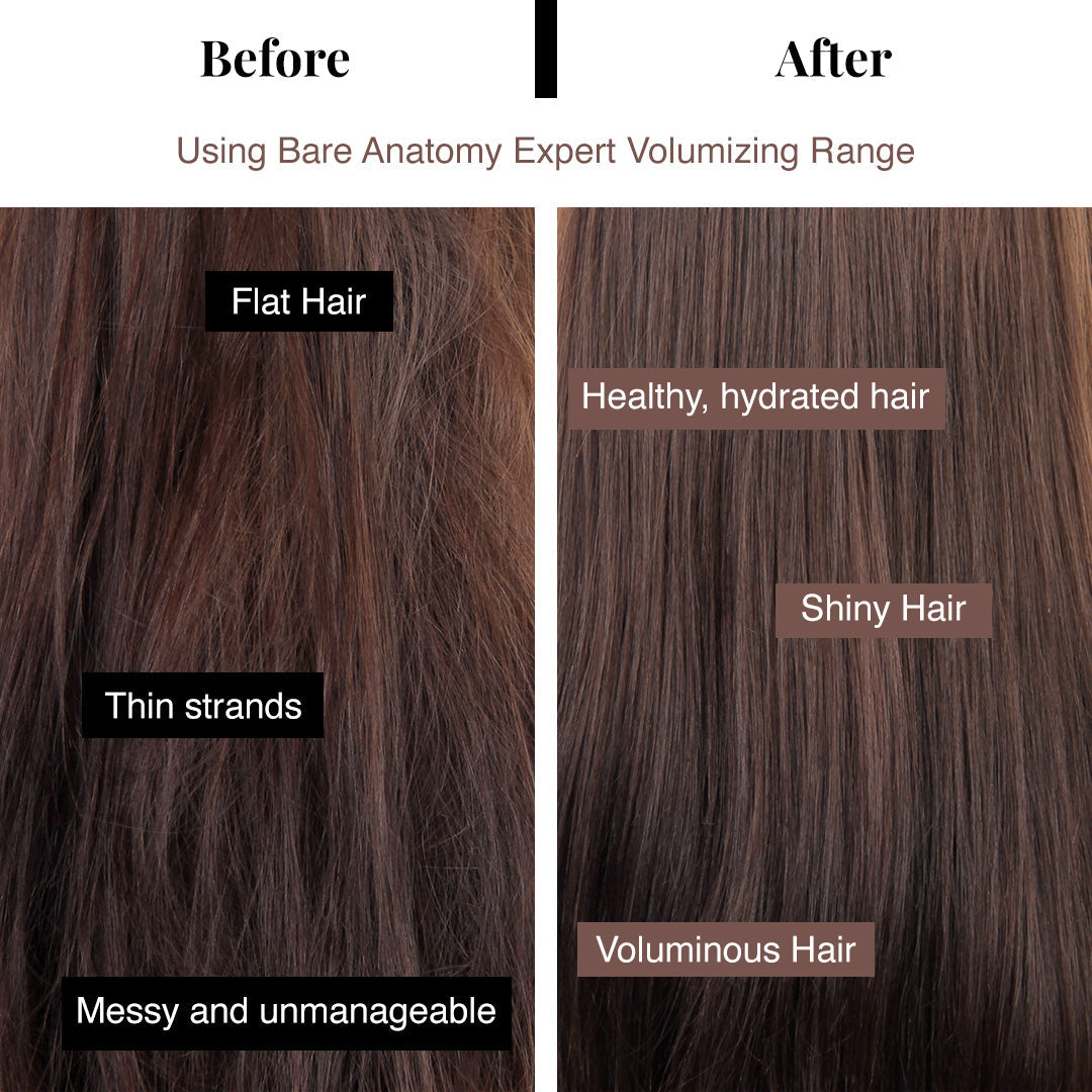 Vanity Wagon | Buy Bare Anatomy Expert Volumizing Hair Shampoo for Thin & Lifeless Hair