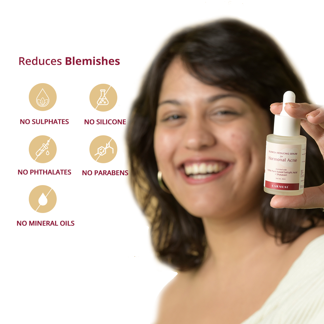 Vanity Wagon | Buy Carmesi Blemish Reducing Serum For Hormonal Acne