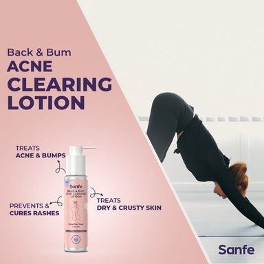 Vanity Wagon | Buy Sanfe Back & Bum Acne Clearing Lotion with Shea Butter & Peach