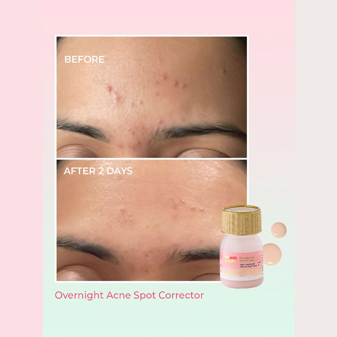The Pink Foundry Overnight Acne Spot Corrector